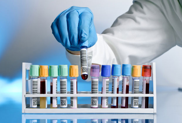 laboratuvar-biyokimya